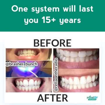 Natural Teeth Whiteners Review 2022
