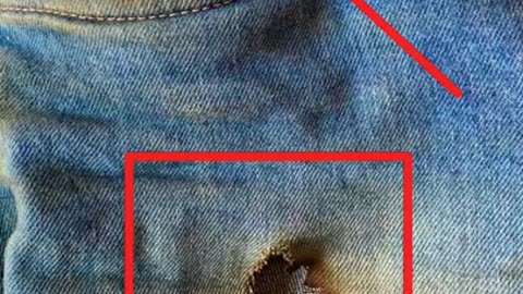 Mobile Blast Injury