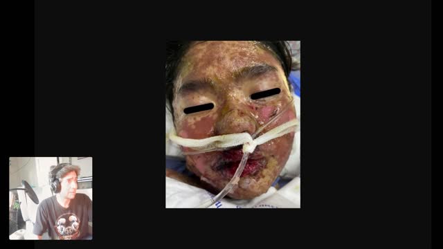 ANOTHER VICTIM OF THE JAB! (The Absolute HORROR!!!!)