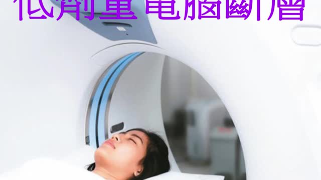 肺癌篩檢 低劑量電腦斷層