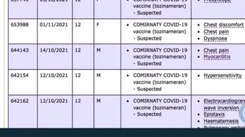 Children having adverse events to CoVid Jab