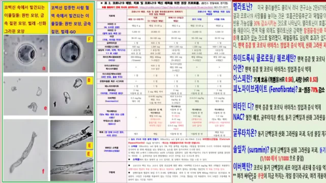 전기엽 원장님의 MMS2 설명