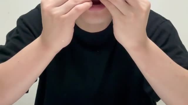 My Friend Did That and His tooth now More Yellow