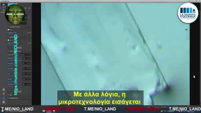 VIDΕΟ - ΔΕΙΤΕ ΤΙ ΣΥΜΒΑΙΝΕΙ ΜΕ ΤΑ ΕΜΒΟΛΙΑ ...ΔΕΙΤΕ ΤΙ ΠΕΡΙΕΧΟΥΝ...