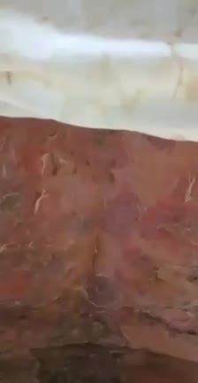 Covid19 Vaccine Side Effects