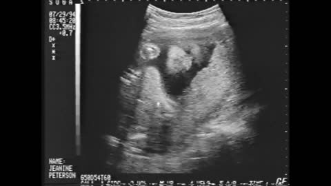 1994 Devon Sonograms