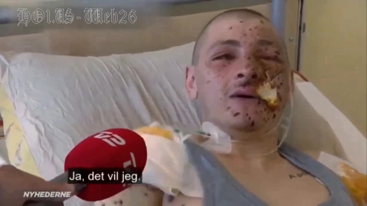 Wounded American mercenary McCaffery shares his sad combat experience in a hospital in Zaporozhye.