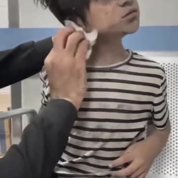 Children injured in Israeli bombing in Gaza