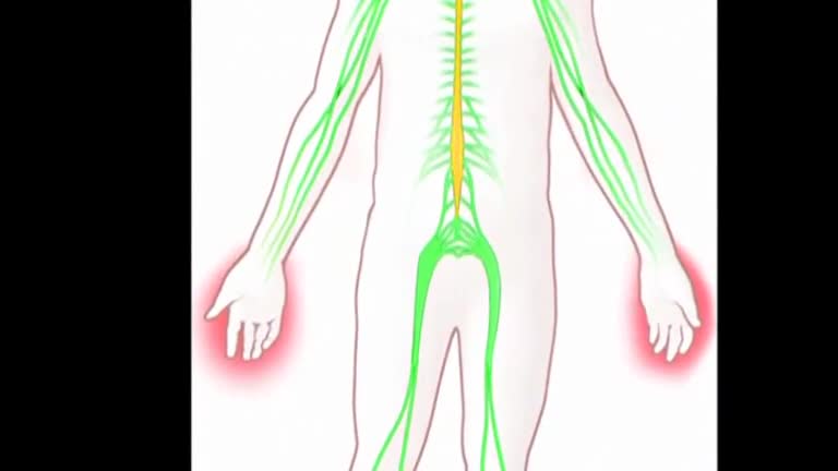 Scrambling away pain for cancer patients