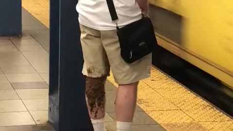 Man with poop on his legs