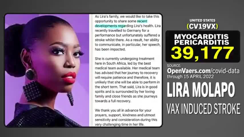 "FIRST AFRICAN BARBIE" SUFFERS VAX INDUCED STROKE AFTER FRIEND IS KILLED BY PFIZER