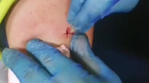 WHAT IS THIS???