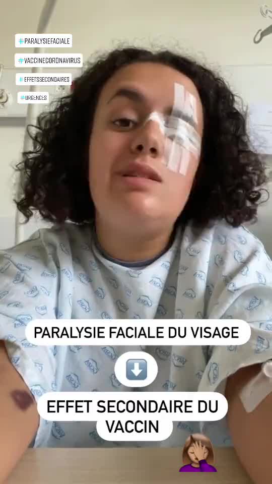 COVID-19: Pfizer - Effets secondaires vaccins - Paralysie de Bell