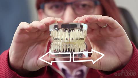 How do braces work to straighten your teeth?