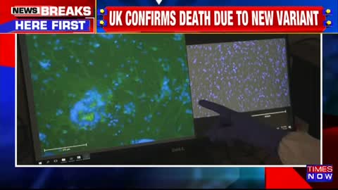 The FIRST Omicron DEATH! In UK, Country Sees Barrage Of Cases 