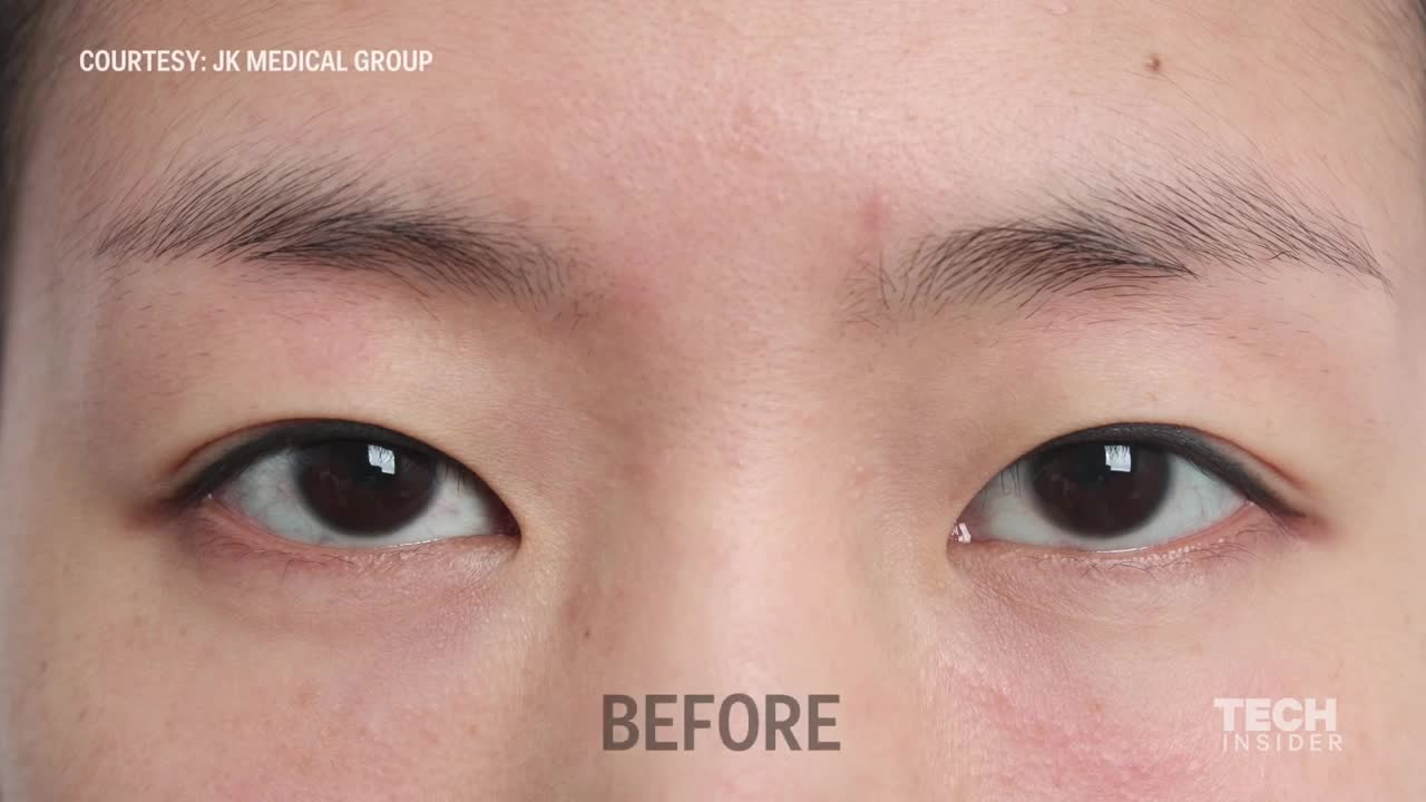 Plastic surgery in South Korea