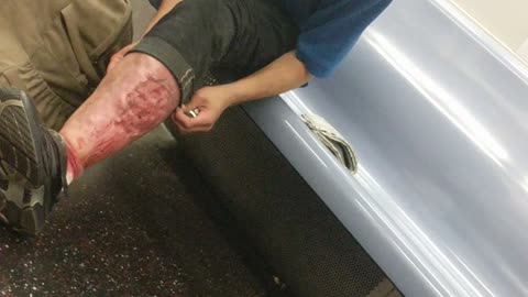 Man in blue shirt injured leg