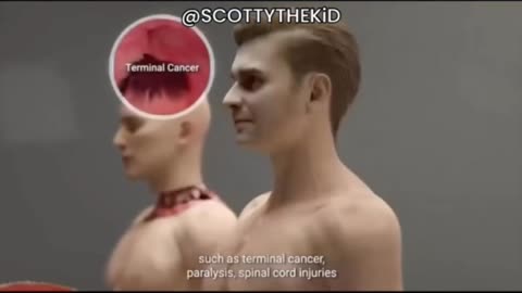 HEAD TRANSPLANTS