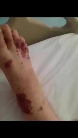 This Is What Happened To Her Mother Two Days After Her Second Jab