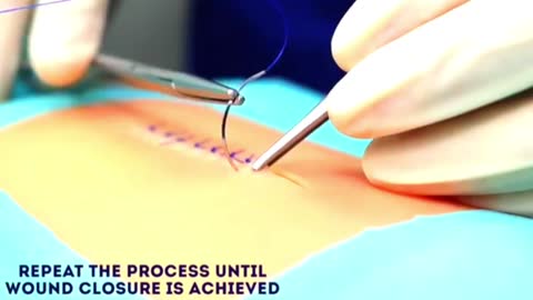 Simple intrupted sutur ( wound suturing ) OSCE guide 🙂
