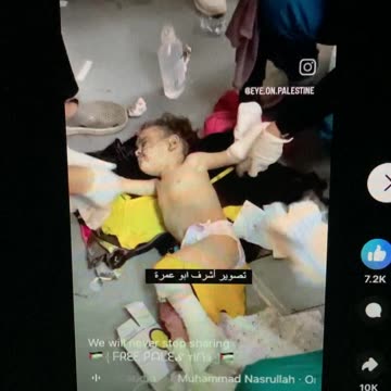 Palestinian child with amputation…