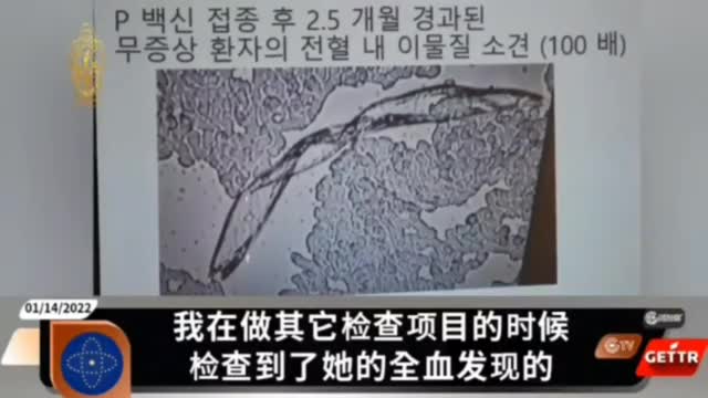 正義的韓國🇰🇷醫生,揭露冠狀病毒疫苗里的“怪異生命體”
