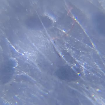 親自驗證拍攝：口罩上有不知名寄生蟲