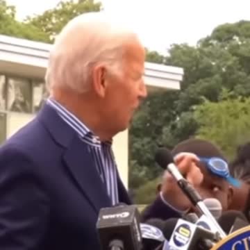 The best hairy legs￼ #UCNYNEWS￼