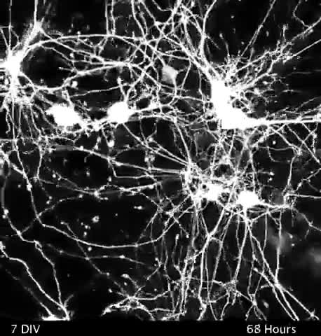 What it Looks Like When NEURONS make Connections and Communicate with Each Other!!!
