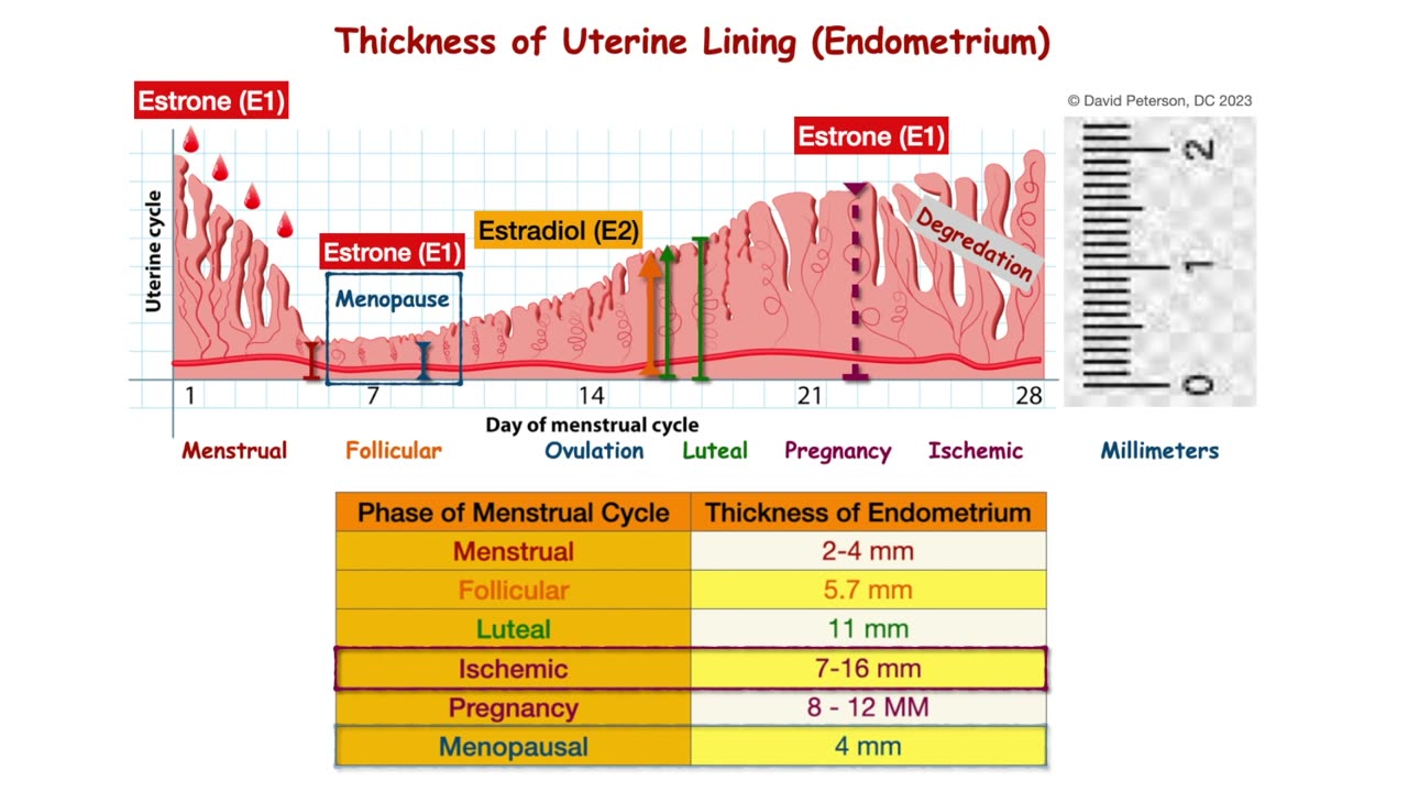 Why Your Uterine Lining Thickness Matters: From Fertility to Menopause