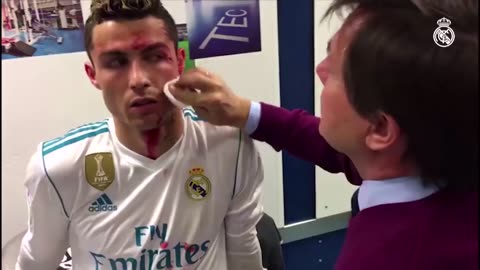 Cristiano Ronaldo INJURY Bloody Face