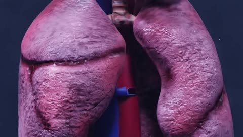 How_Snake_Bite_Kill_You___3D_Animation__#shorts