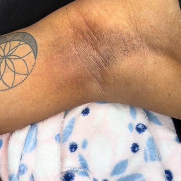 Underarm Waxing Tutorial with Sexy Smooth Purple Seduction Hard Wax | Presented by IdyllSociety