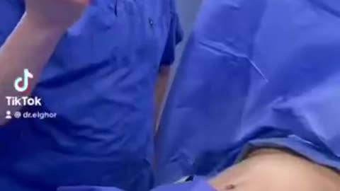 شد ترهلات البطن قبل وبعد _ دكتور محمد الغر