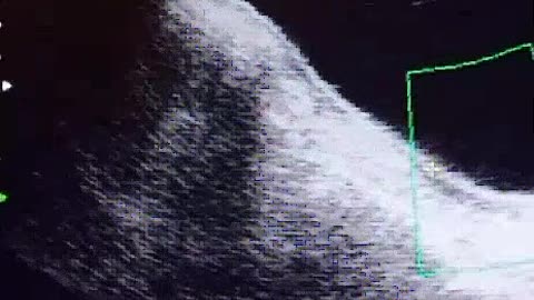 (radiology78) youtube instagram twitter twitch tiktalk dailymotion rumble