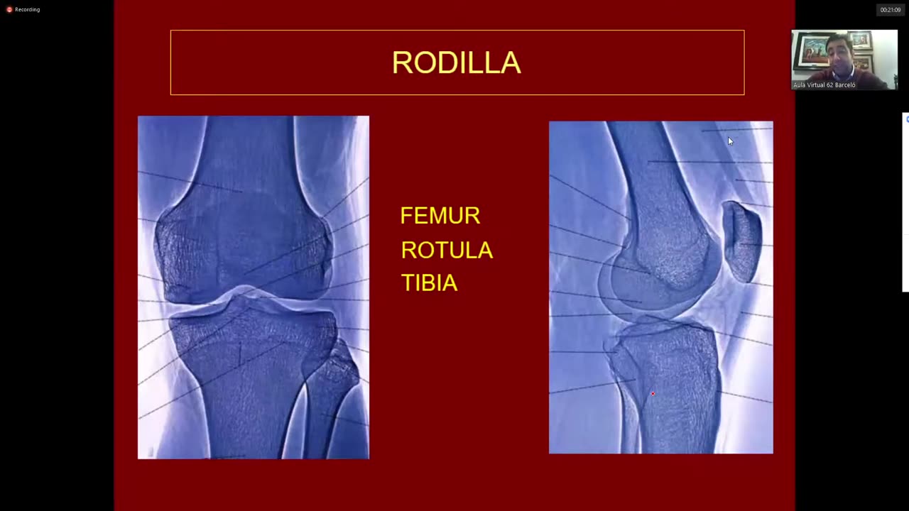 Clase 14 - Repaso Miembro Inferior 2_2 - Dr. Sergio Paez 31-05-2021