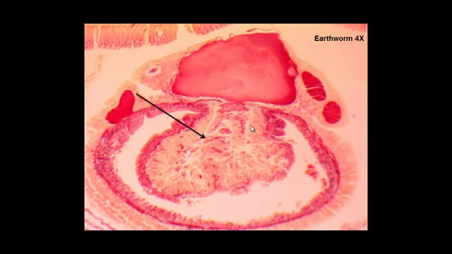 Earthworm Cross Section_Cut