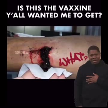 The Vaccine 💉 Results 👀