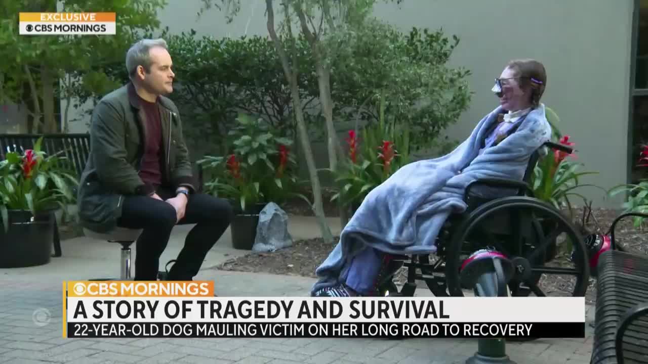 "It's time to show who I am now": Dog sitter recovering after losing face in horrific dog attack