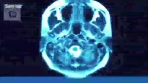 How they make clones. Cloning since1918, 1938 they started making Hitler clones...