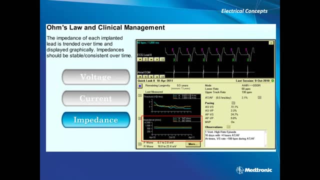 UTHealth EP Heart CV/EP Training Program - Basic Pacing Concepts