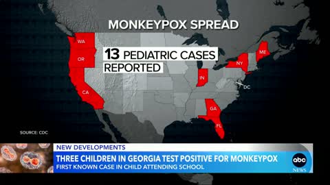 3 Georgia children test positive for monkeypox l GMA