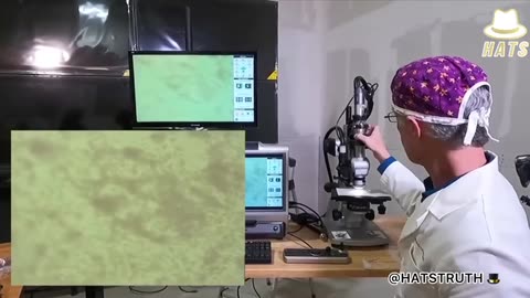 權威科學家暨世界炎症首席專家Dr.Richard Fleming博士，以高倍電子顯微鏡驗證顯示，當“新冠疫苗實驗針劑”直接打入人體血液中時，會出現什麼變化？