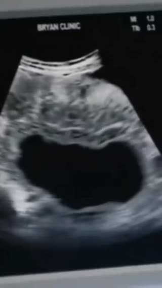 The Dictator Minister of the @STF_oficial Rosa Weber has just sponsored this in Brazil.