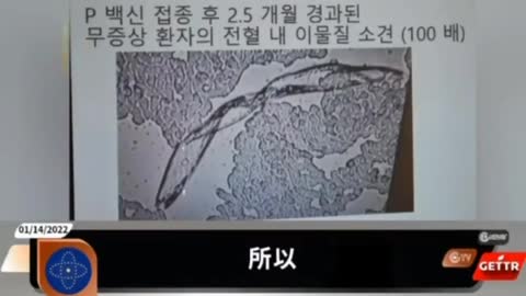 除了歐美、日本🇯🇵，現在韓國🇰🇷醫生也報料疫苗內有異物的內容了。 巧合還是⋯？