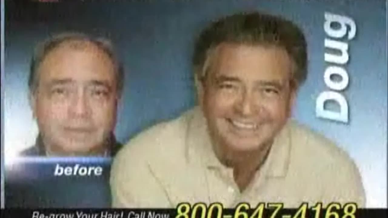 Medical Hair Restoration Commercial