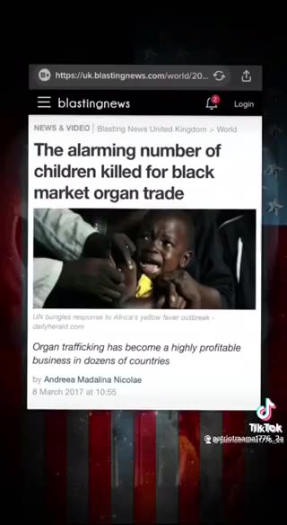 Expose Organ Harvesting