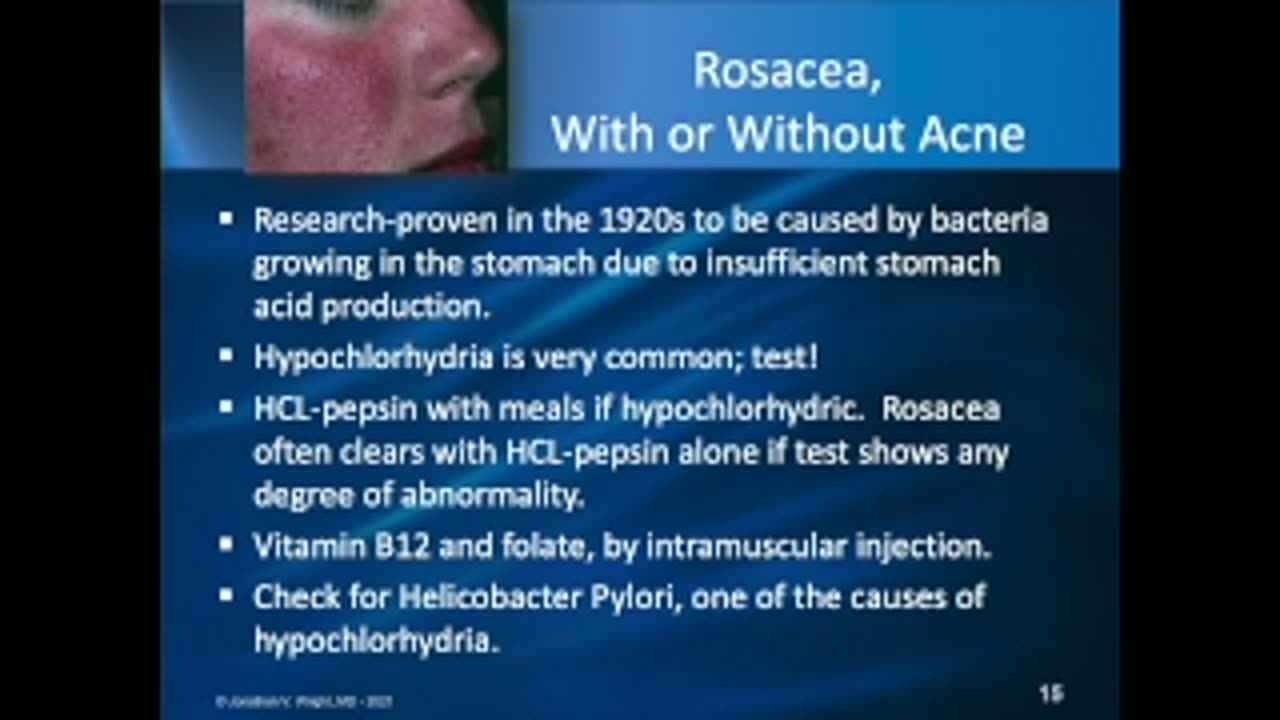 Body Language – Clues from the Physical Exam for Testing and Treatment. Jonathan Wright, MD, ND