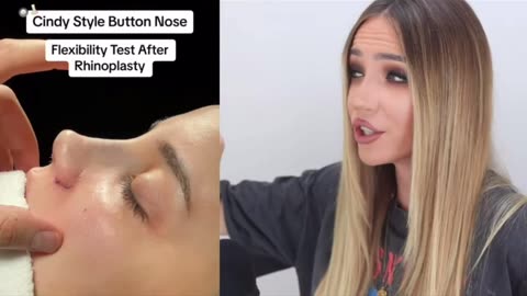 Nose Job Crisis