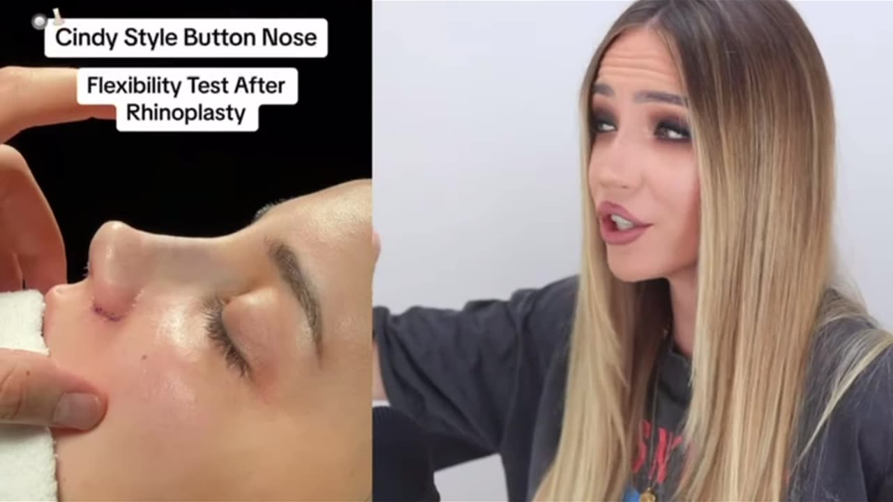 Nose Job Crisis